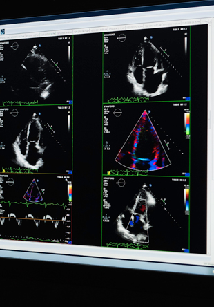 Access to leading tests and tools to diagnose a wide spectrum of heart diseases and conditions