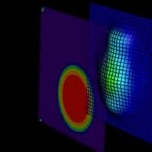 Stanford Hospitals & Clinics: laser vision correction: wavefront LASIK