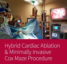 Image of hybrid-cardiac-ablation-minimally-invasive-cox-maze-procedure.jpg
