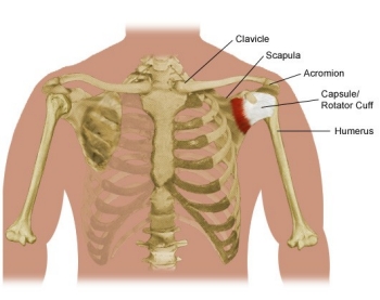 Illustration showing shoulder pain and anatomy. 