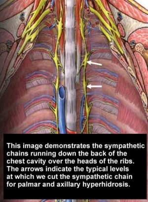 diagram of sympathetic nerve chains in the chest