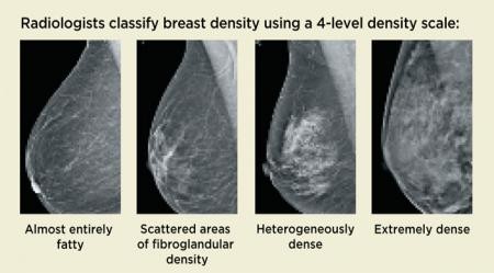 xrays imaging of breast density