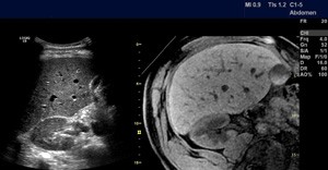 ultrasound image example